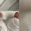 Ребёнок получил сильные ожоги в детском саду